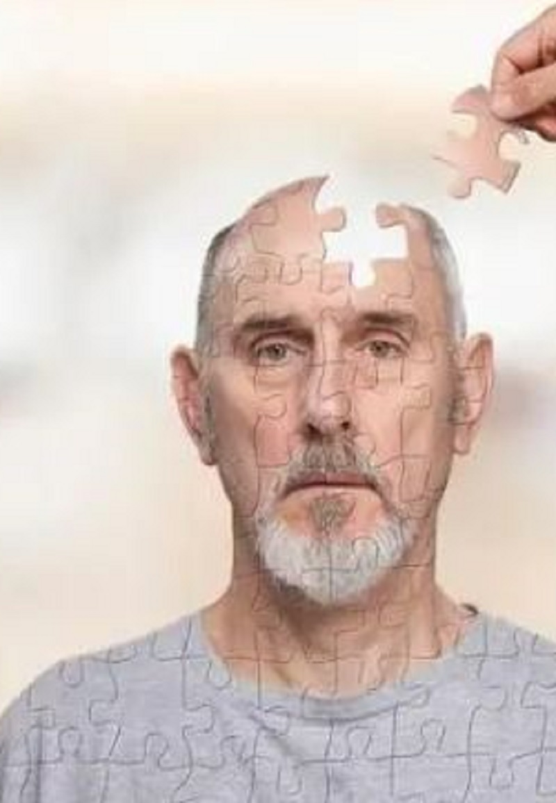 alzheimer